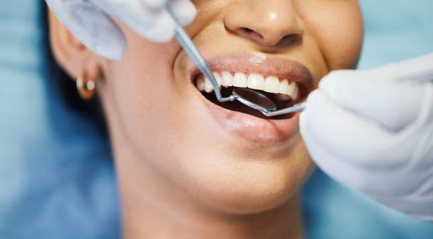 Best Emergency Tooth Extraction in Dubach, LA